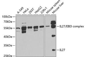 Western blot analysis of extracts of various cell lines, using IL27 antibody (ABIN6129040, ABIN6142372, ABIN6142373 and ABIN6221166) at 1:1000 dilution. (IL-27 anticorps  (AA 29-243))