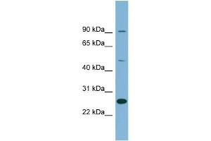 WB Suggested Anti-LRRC49 Antibody Titration: 0. (LRRC49 anticorps  (N-Term))