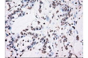 Image no. 15 for anti-Polo-Like Kinase 1 (PLK1) antibody (ABIN1500282)