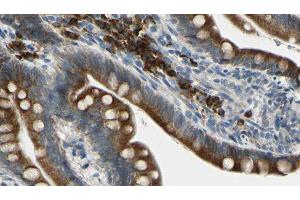 ABIN6276238 at 1/100 staining Mouse intestine tissue by IHC-P. (GIPR anticorps  (Internal Region))