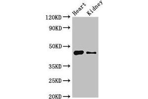 Western Blot Positive WB detected in: Mouse heart tissue, Mouse kidney tissue All lanes: MNDA antibody at 4 μg/mL Secondary Goat polyclonal to rabbit IgG at 1/50000 dilution Predicted band size: 46 kDa Observed band size: 46 kDa (MNDA anticorps  (AA 84-233))