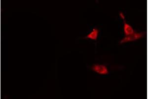 ABIN6274112 staining HeLa cells by IF/ICC.