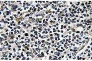Immunohistochemistry (IHC) analyzes of p-ZAP-70 antibody in paraffin-embedded human thymus gland tissue. (ZAP70 anticorps  (pTyr319))
