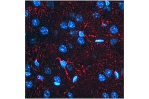 Immunofluorescent BACE1 detection in mouse astrocytes (red fluorescence).