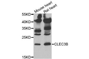 Western blot analysis of extracts of mouse heart and rat heart tissues, using CLEC3B antibody. (CLEC3B anticorps)