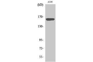 Western Blotting (WB) image for anti-Nitric Oxide Synthase 1, Neuronal (NOS1) (Thr175), (Tyr177) antibody (ABIN3185935) (NOS1 anticorps  (Thr175, Tyr177))