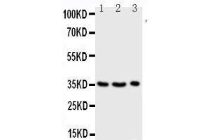 Anti-Granzyme A antibody, Western blotting Lane 1: JURKAT Cell Lysate Lane 2: CEM Cell Lysate Lane 3: RAJI Cell Lysate (GZMA anticorps  (Middle Region))