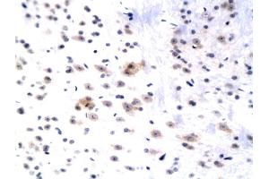 Formalin-fixed and paraffin embedded rat hippocampus labeled with Anti WIF1 Polyclonal Antibody, Unconjugated (ABIN751108) followed by conjugation to the secondary antibody and DAB staining (WIF1 anticorps  (AA 51-150))