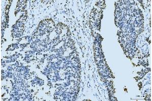 IHC analysis of MCM6 using anti-MCM6 antibody (ABIN7600037). (MCM6 anticorps  (AA 14-821))