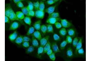 IF analysis of Caspase-5/CASP5 using anti-Caspase-5/CASP5 antibody (ABIN7599992).