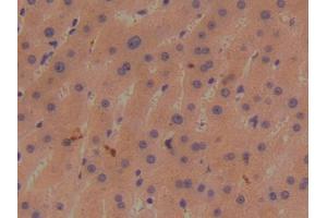 DAB staining on IHC-P; Samples: Human Liver Tissue (BMP1 anticorps  (AA 610-843))