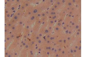 DAB staining on IHC-P; Samples: Human Liver Tissue (BMP1 anticorps  (AA 610-843))