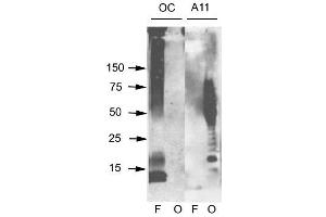Amyloid Fibrils Western Blot. (Amyloid Fibrils anticorps)