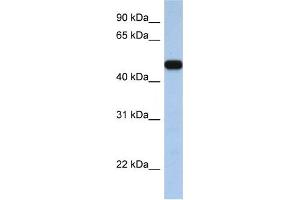 Western Blotting (WB) image for anti-Solute Carrier Family 25, Member 46 (SLC25A46) antibody (ABIN2458810) (SLC25A46 anticorps)