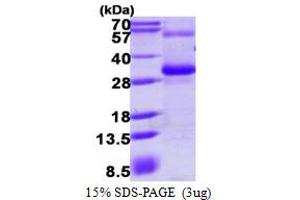 SDS-PAGE (SDS) image for Regulator of G-Protein Signaling 17 (RGS17) (AA 1-210) protein (His tag) (ABIN667548)