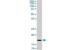 BATF monoclonal antibody (M01), clone 8A12.