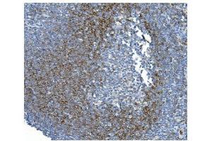 IHC analysis of CD79b using anti-CD79b antibody (ABIN7601115).
