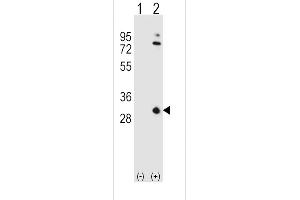 Western blot analysis of OA1 (arrow) using rabbit polyclonal OA1 Antibody (N-term) 7414a. (APOA1 anticorps  (N-Term))