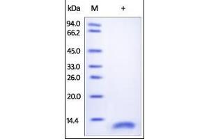 Human CD9, His Tag on SDS-PAGE under reducing (R) condition. (CD9 Protein (CD9) (AA 112-195) (His tag))