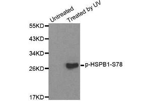 Western blot analysis of extracts from HL60 cells, using Phospho-HSPB1-S78 antibody (ABIN2987689). (HSP27 anticorps  (pSer78))