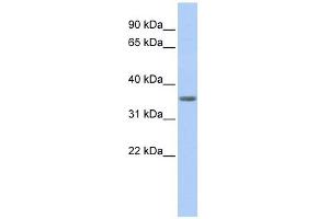 UBE2F antibody used at 1 ug/ml to detect target protein. (UBE2F anticorps)