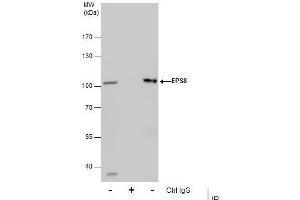 IP Image Immunoprecipitation of EPS8 protein from HepG2 whole cell extracts using 5 μg of EPS8 antibody [C3], C-term, Western blot analysis was performed using EPS8 antibody [C3], C-term, EasyBlot anti-Rabbit IgG  was used as a secondary reagent. (EPS8 anticorps  (C-Term))