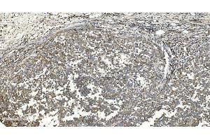 IHC analysis of NOX2/gp91phox/CYBB using anti-NOX2/gp91phox/CYBB antibody (ABIN7599875). (CYBB anticorps  (AA 124-559))