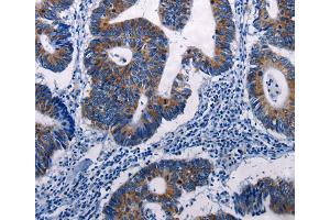 Immunohistochemistry (IHC) image for anti-Dual Specificity Phosphatase 6 (DUSP6) antibody (ABIN2428103) (DUSP6 anticorps)