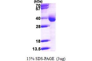 SDS-PAGE (SDS) image for Cytochrome B5 Reductase 3 (CYB5R3) (AA 27-301) protein (His tag) (ABIN667656) (CYB5R3 Protein (AA 27-301) (His tag))