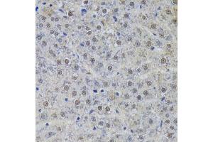 Immunohistochemistry of paraffin-embedded rat liver using SNRPA Antibody. (SNRPA1 anticorps  (AA 1-282))