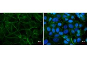 ICC/IF Image E-cadherin antibody detects E-cadherin protein by immunofluorescent analysis.