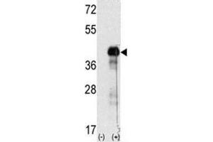 Western blot analysis of SOX-2 antibody and 293 cell lysate (2 ug/lane) either nontransfected (Lane 1) or transiently transfected with the SOX2 gene (2). (SOX2 anticorps  (AA 89-119))