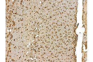 ABIN7094428 and ABIN7098476 at 1/100 staining Rat brain tissue by IHC-P. (GJB6 anticorps  (C-Term))
