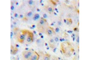 Used in DAB staining on fromalin fixed paraffin-embedded Liver tissue (MST1R anticorps  (AA 1092-1316))