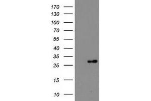 Western Blotting (WB) image for anti-Deoxythymidylate Kinase (Thymidylate Kinase) (DTYMK) antibody (ABIN1497925) (DTYMK anticorps)