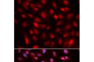 Immunofluorescence analysis of U2OS cells using SUMO2 Polyclonal Antibody