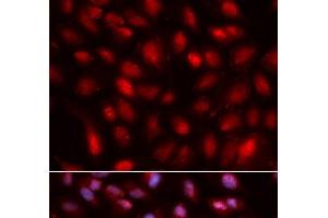 Immunofluorescence analysis of U2OS cells using SUMO2 Polyclonal Antibody (SUMO2 anticorps)