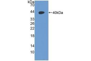 Detection of Recombinant RAD51, Human using Polyclonal Antibody to RAD51 Homolog (RAD51)
