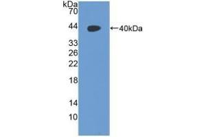 Detection of Recombinant RAD51, Human using Polyclonal Antibody to RAD51 Homolog (RAD51) (RAD51 Homolog anticorps  (AA 2-339))