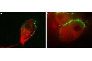 Colocalization of GluR1 and Vesicular GABA Transporter in human U-87 MG cells - Immunocytochemical staining of human glioblastoma U-87 MG.