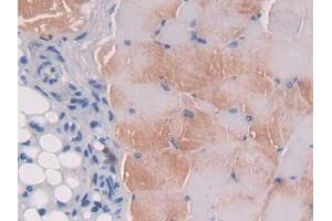 IHC-P analysis of Mouse Skeletal muscle Tissue, with DAB staining. (IL12B anticorps  (AA 35-302))