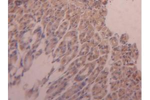 DAB staining on IHC-P; Samples: Mouse Adrenal gland Tissue (Hexokinase 1 anticorps  (AA 530-675))