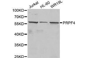 Western Blotting (WB) image for anti-PRP4 Pre-mRNA Processing Factor 4 Homolog (PRPF4) antibody (ABIN1877079) (PRPF4 anticorps)