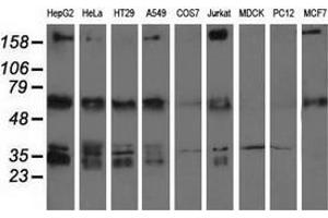 Western blot analysis of extracts (35 µg) from 9 different cell lines by using anti-IGF2BP2 monoclonal antibody. (IGF2BP2 anticorps)