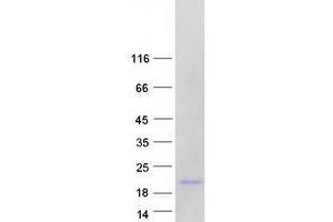 Validation with Western Blot