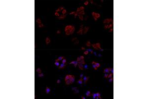 Immunofluorescence analysis of HeLa cells using CD40L antibody (ABIN6133614, ABIN6138190, ABIN6138191 and ABIN6216826) at dilution of 1:100. (CD40 Ligand anticorps  (AA 79-129))