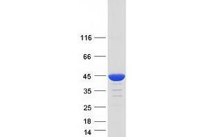 Validation with Western Blot