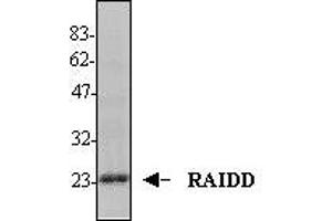 Image no. 1 for anti-CASP2 and RIPK1 Domain Containing Adaptor with Death Domain (CRADD) (AA 1-199) antibody (ABIN187937) (CRADD anticorps  (AA 1-199))