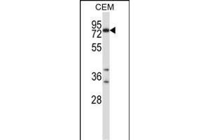 Mouse Plk2 Antibody (Center) (ABIN658003 and ABIN2846947) western blot analysis in CEM cell line lysates (35 μg/lane). (PLK2 anticorps  (AA 354-382))