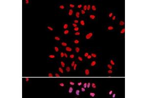 Immunofluorescence analysis of U2OS cells using DKC1 Polyclonal Antibody (DKC1 anticorps)